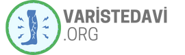 VarisTedavi